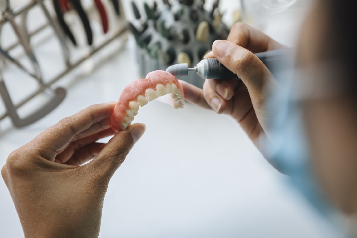 Dentures at Smile Boutique Thousand Oaks — 2
