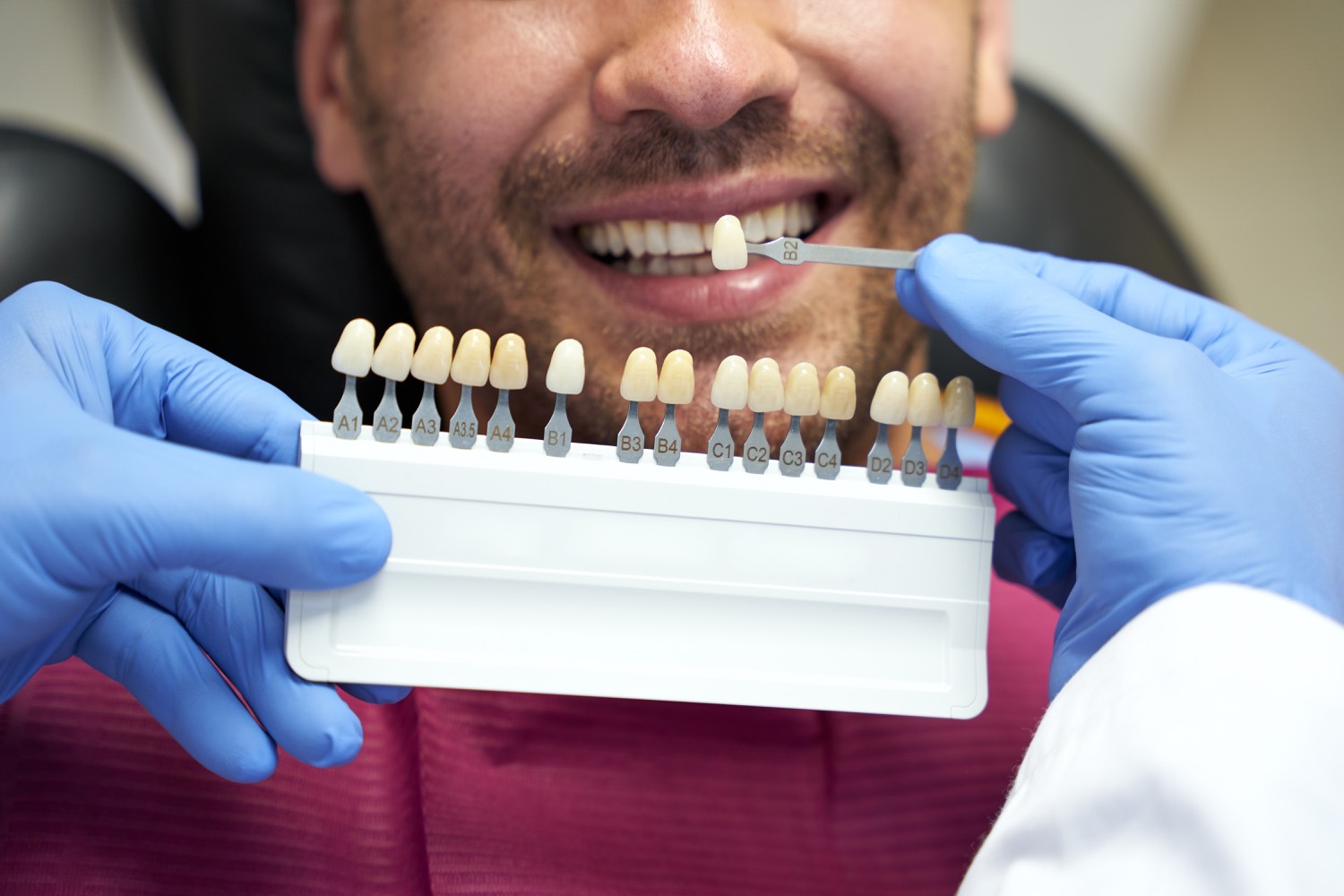 Porcelain veneers in Thousand Oaks