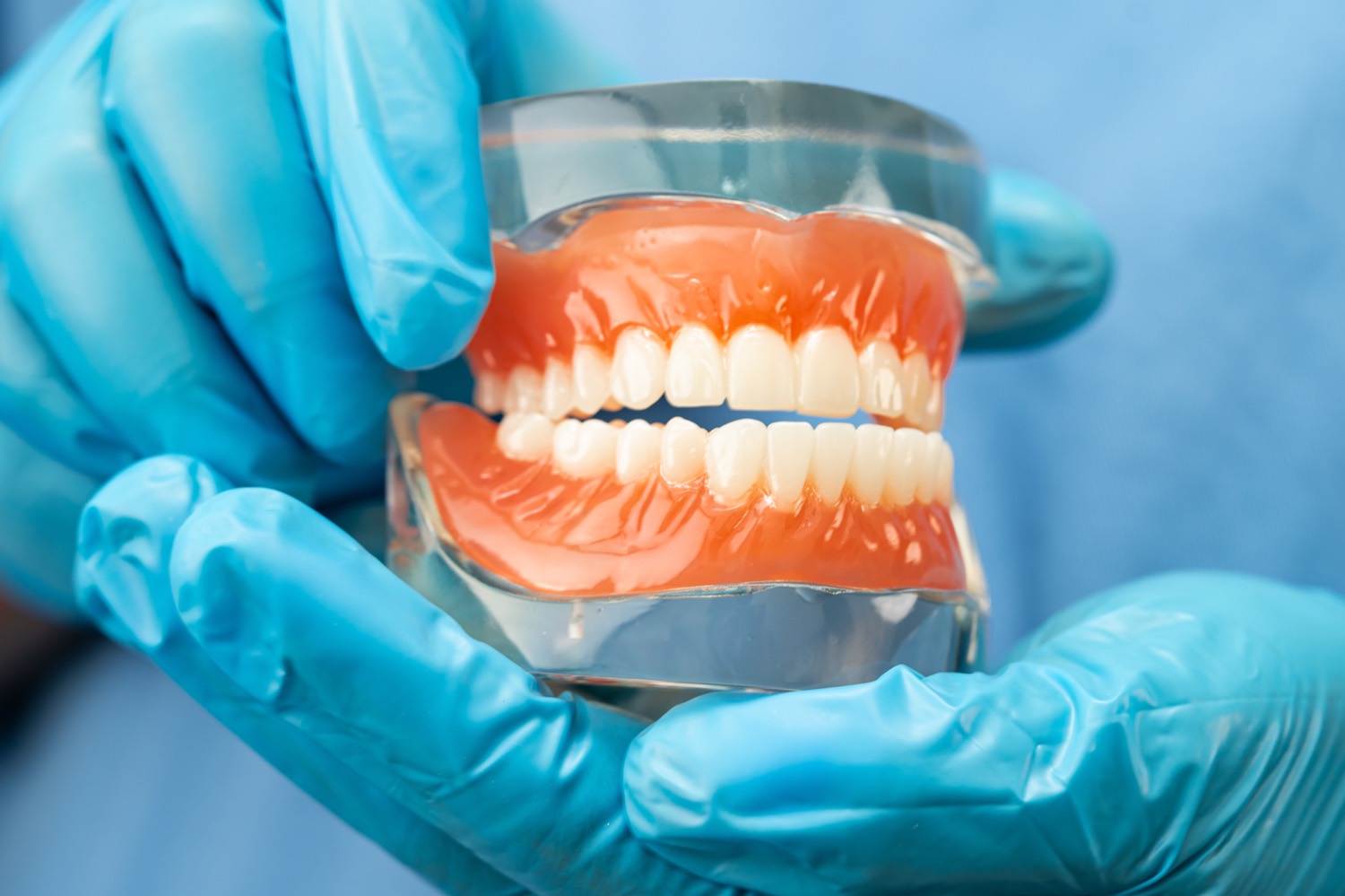 Denture Stabilization — Smile Boutique Thousand Oaks