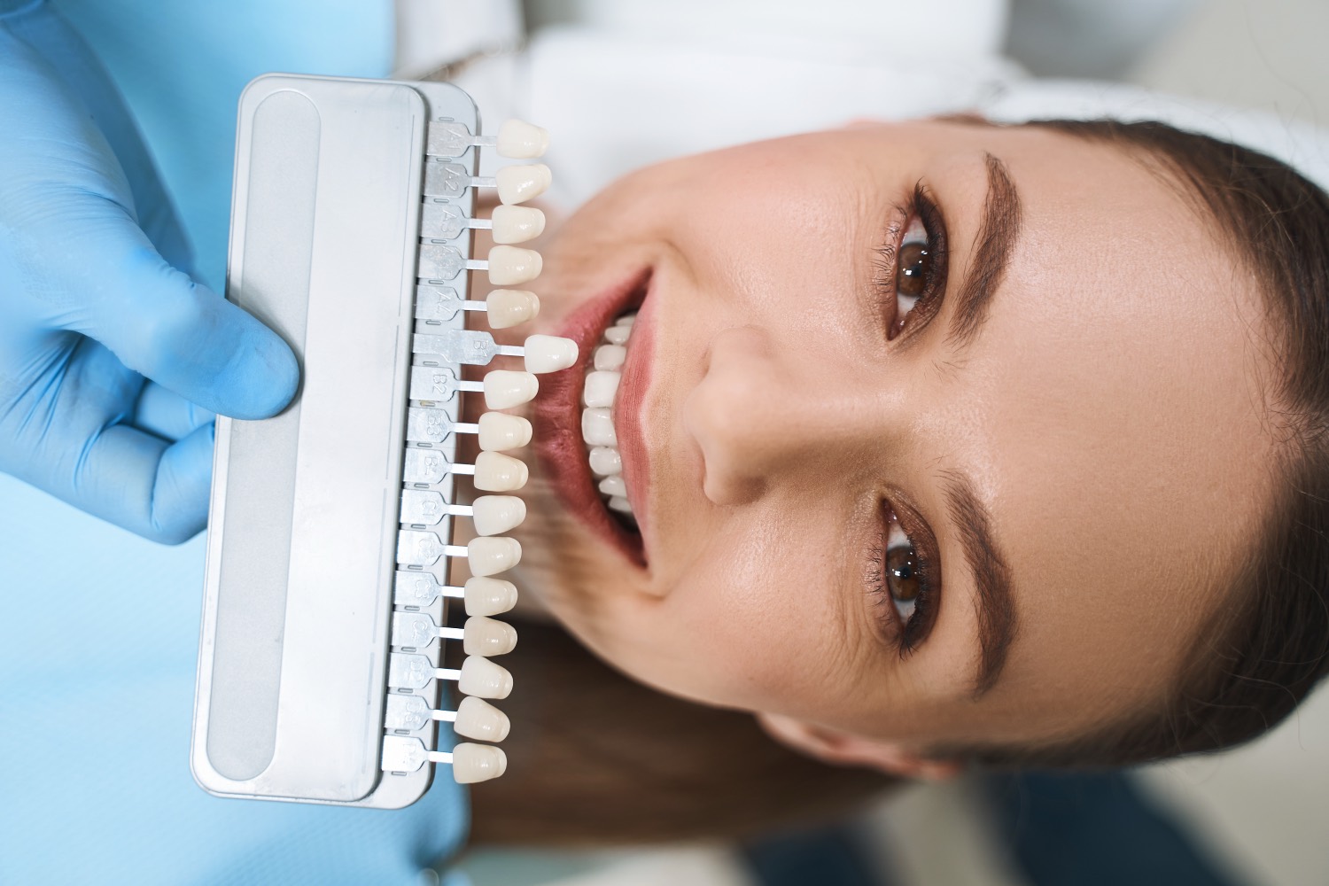 Porcelain Veneers — Smile Boutique Thousand Oaks