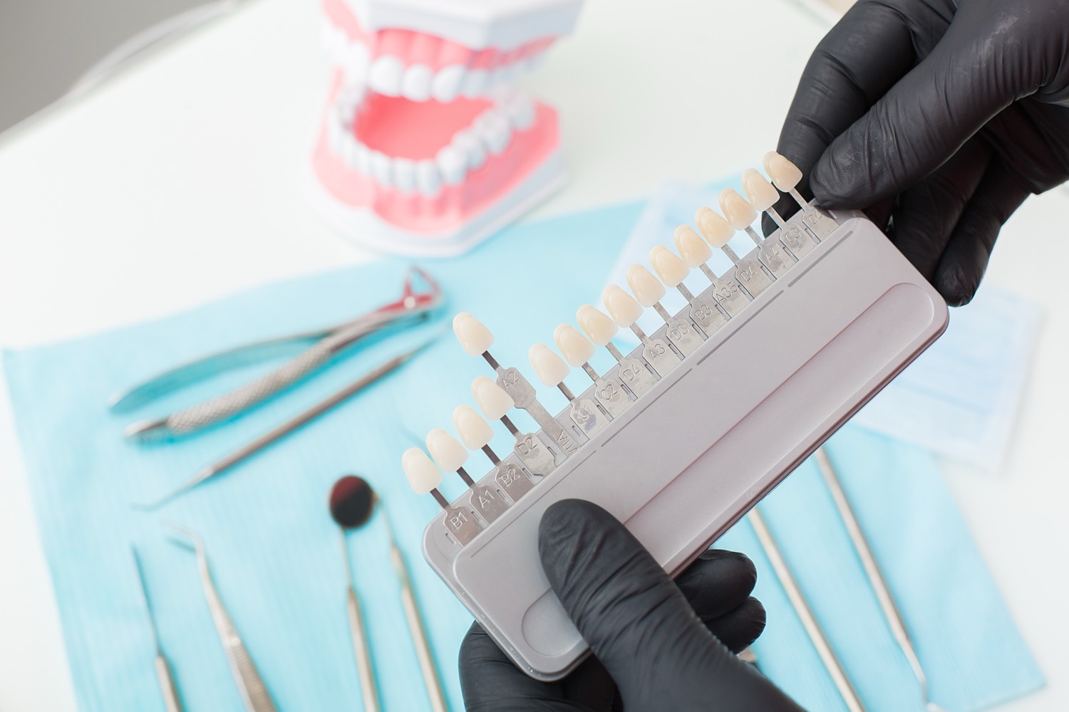 Porcelain Veneers at Smile Boutique Thousand Oaks — 2